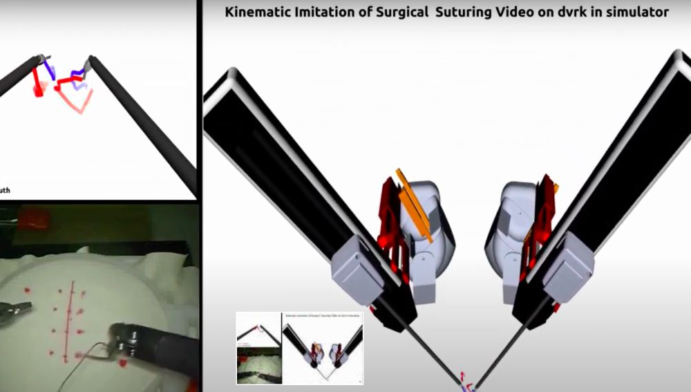 Enseñan a un robot a suturar en cirugías mostrándole vídeos de cómo lo hacen los cirujanos