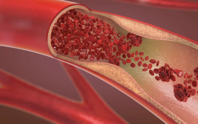 Un robot quirúrgico de mano puede ayudar a detener la pérdida de sangre