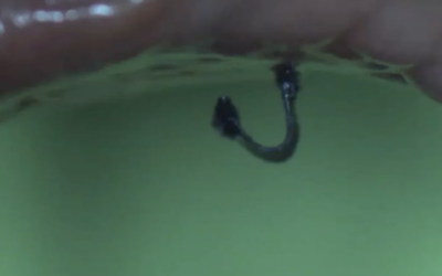 Este micro-robot puede escalar por tus tripas como un insecto, pero tiene buenas intenciones