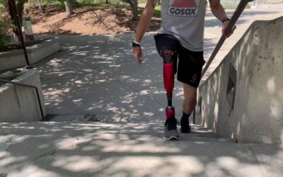 Una nueva prótesis robótica ligera permite subir escaleras y dar zancadas