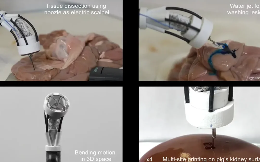 Crear órganos con impresión 3D dentro del cuerpo humano: este nuevo robot ya es capaz de hacerlo