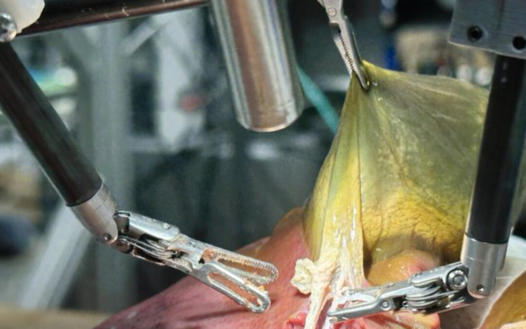 Cirugía robótica autónoma: Un robot con IA realizó operaciones exitosas en cerdos y podría probarse en humanos en 10 años